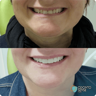 antes-depois-4