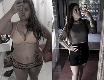 Antes e Depois 3