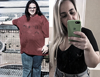 Antes e Depois 5-2