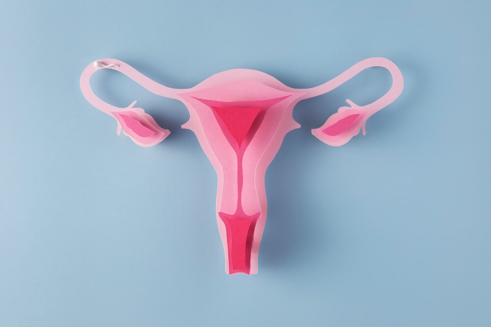 Endometriose